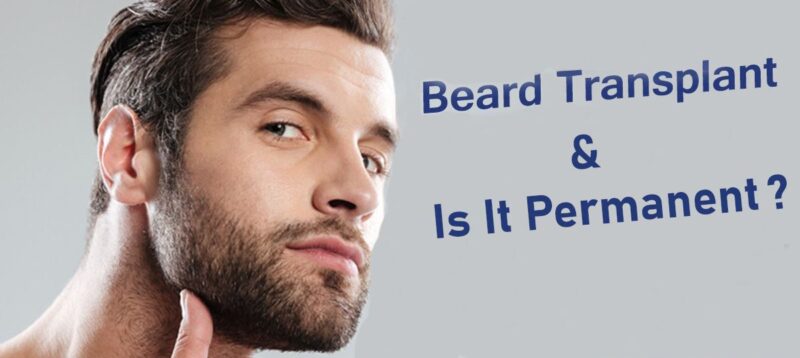 Is it possible to get Beard hair transplant in Pakistan | How much does Cost