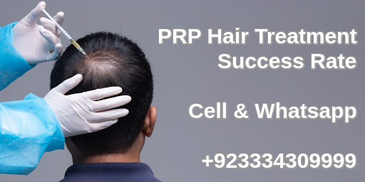 PRP Hair Treatment Success Rate in Pakistan | Best hair loss Clinic