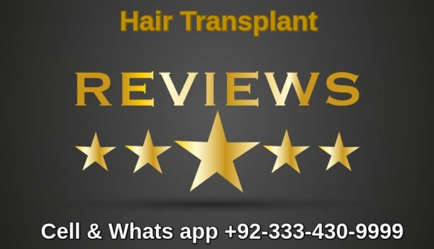hair transplant review Pakistan