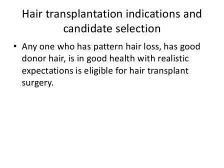 Eligibility Criteria for Hair Transplant
