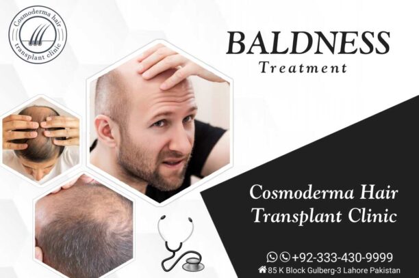 Advance hair transplant technique Pakistan