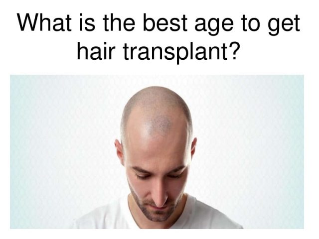 Best age to get hair transplant Pakistan