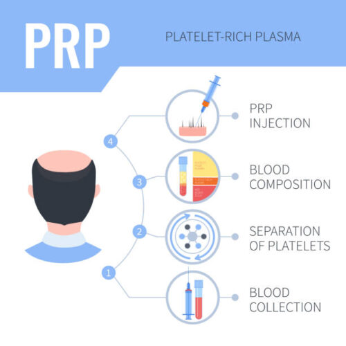 PRP for hair loss treatment Pakistan