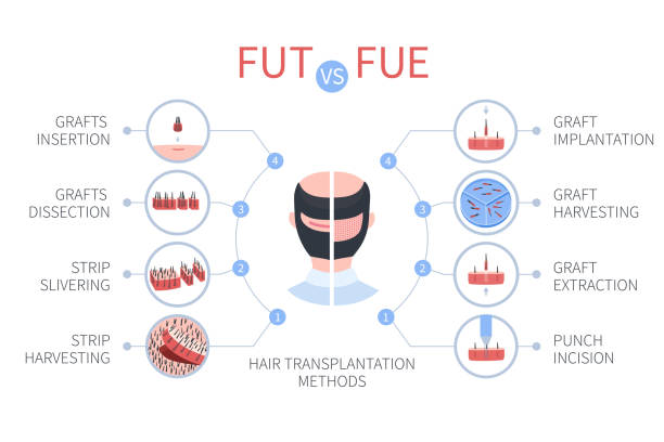 FUT-FUE techniques