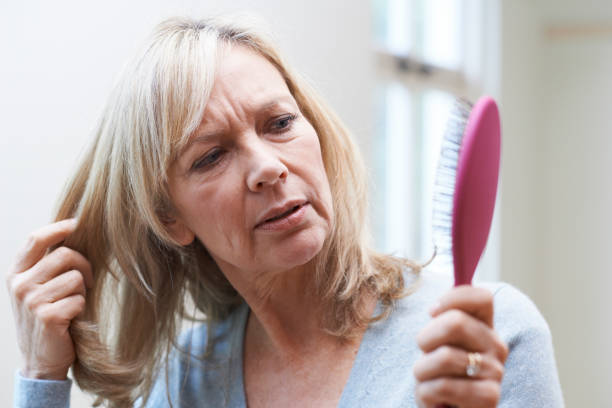 mature women hair loss