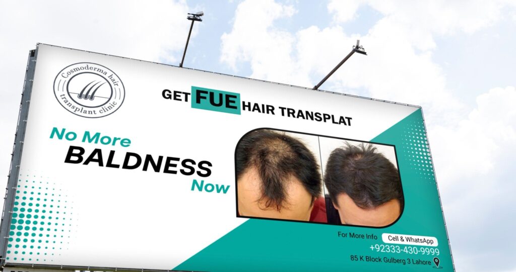 Best age to get hair transplant 